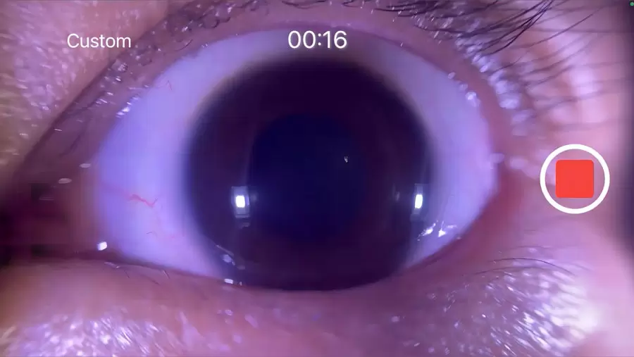 Video VertiMobile